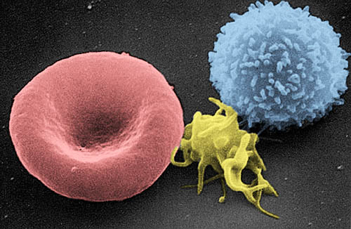 Scanning electron micrograph of a red blood cell (left), a platelet (center), and a T lymphocyte (right) 