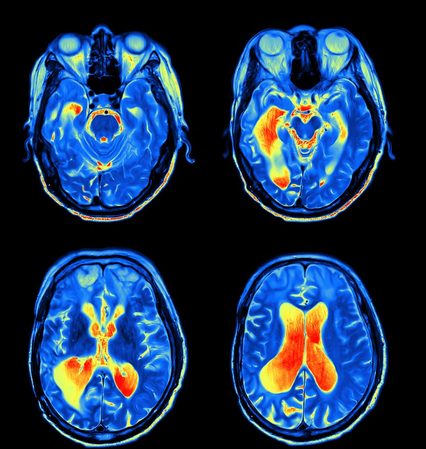 Colour-enhanced MRI of brain and eyes 