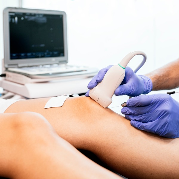 Ultrasound treatment on knee