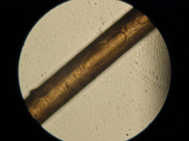 Shown is a colour photograph of a translucent brown tube across a beige circle, framed in black.