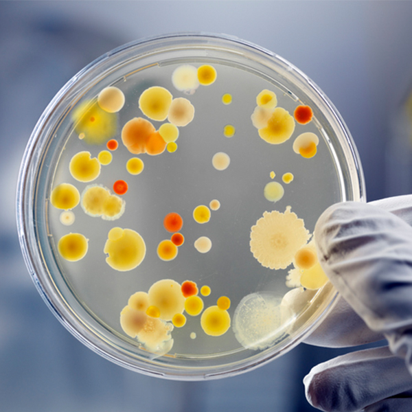 Hand holding petri dish with bacteria