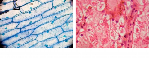 Onion cells, a type of plant cell, on the left and frog cells, a type of animal cell, on the right 