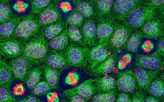 Mitosis of kidney cells © Ian P Newton & Paul L Appleton [CC BY-SA 4.0], Wikimedia Commons