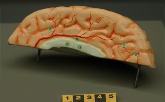 3D representation of a portion of human female brain