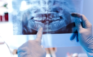 dental x-ray 