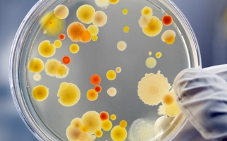Hand holding petri dish with bacteria