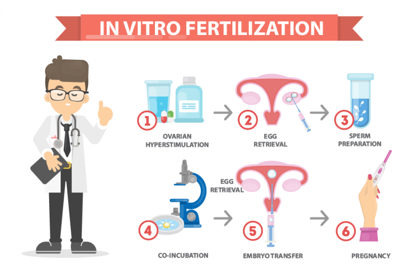 The steps of in vitro fertilization 