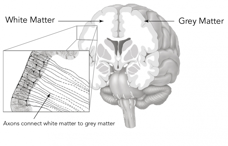 Locations in the brain of white matter and grey matter as well as the axons that connect them together 