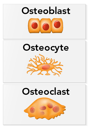 The three main types of bone cells are osteoblasts, osteocytes and osteoclasts