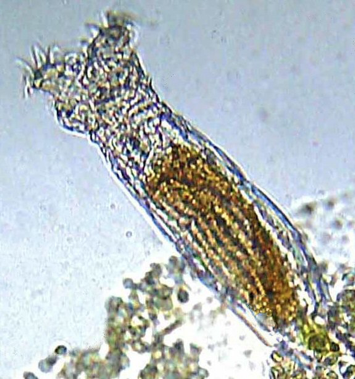 Microscopic rotifer 