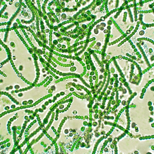 Cyanobacteria from the genus Nostoc