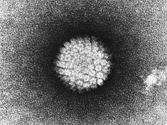 Electron micrograph of a negatively stained human papilloma virus (HPV) which occurs in human warts