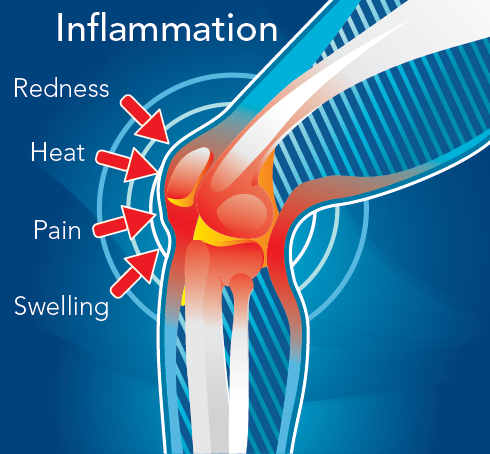 Symptoms of an inflammatory response