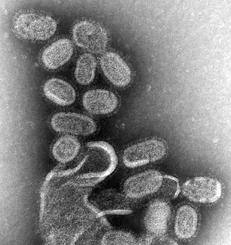 Electron microscope image of influenza viruses