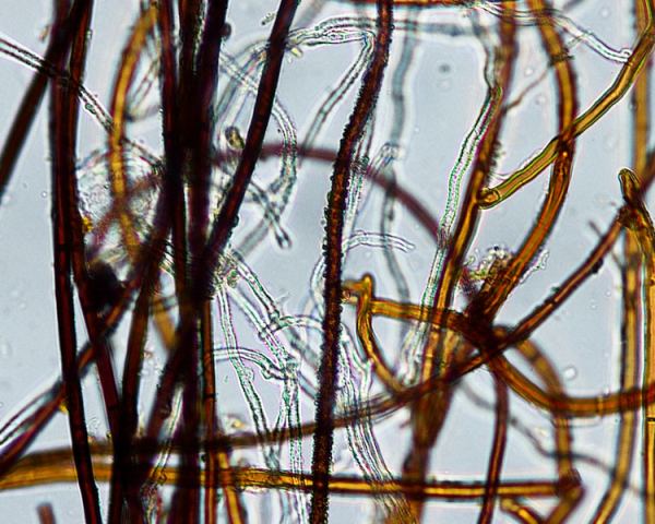 Shown is a colour photograph of long, thin, tangled strands of fungal hyphae. 